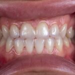 Antybiotyk na zęba – kiedy jest potrzebny, a kiedy nie przyniesie żadnej poprawy?